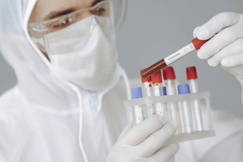 Pathogen Testing in Spices