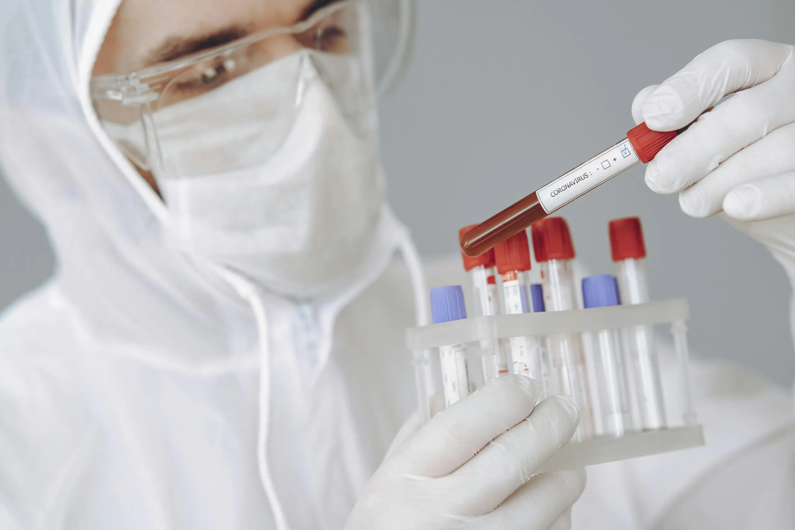 Pathogen Testing in Spices